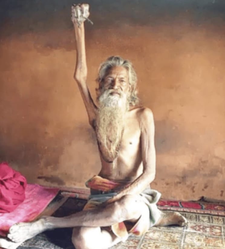 Inspired by his deep-seated beliefs, Sadhu Amar practiced 24/7 saluting his right arm overhead. After a few focussed months, his fascia/connective tissue took over the task of “stabilizing”, and his arm has been stuck in a salute —immobilized & useless like a dead tree branch—for over 40 years.